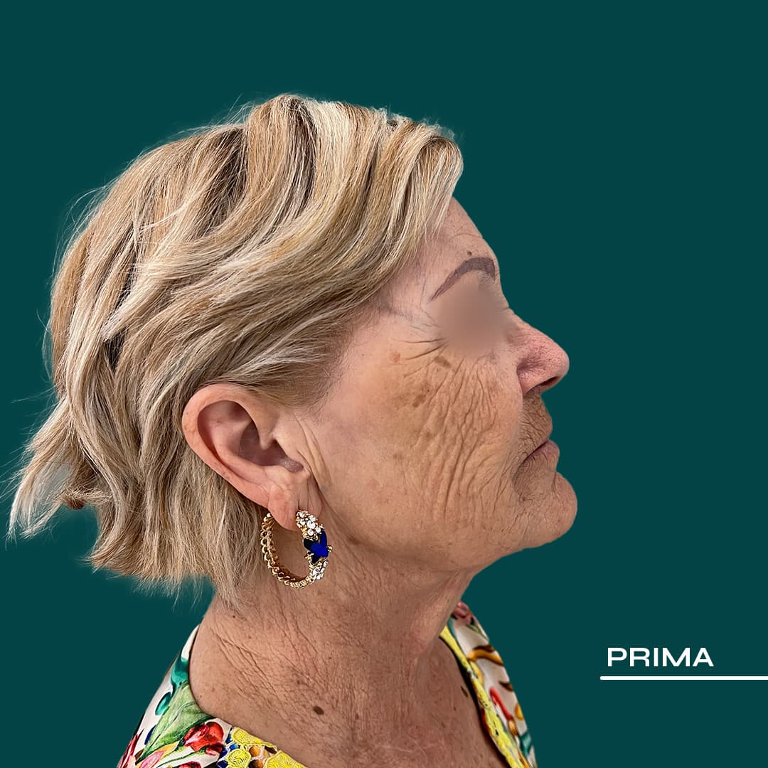 Prima