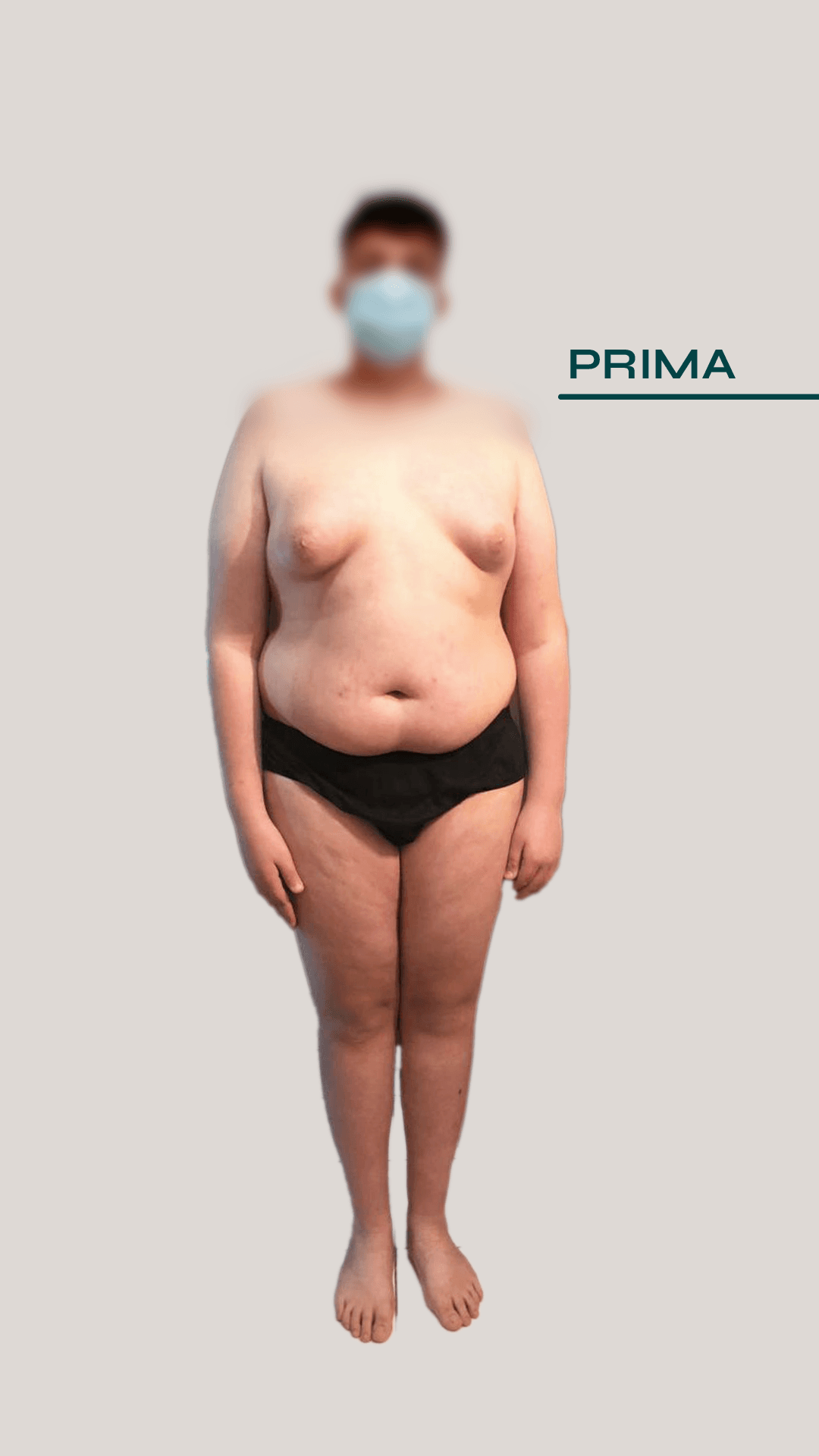 Prima